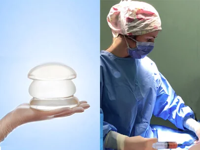 Breast-implant-fat