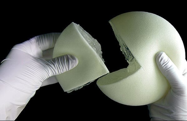 Breast-implants-Sydney
